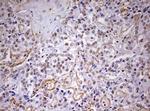 DDX56 Antibody in Immunohistochemistry (Paraffin) (IHC (P))