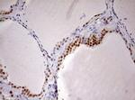 DDX56 Antibody in Immunohistochemistry (Paraffin) (IHC (P))