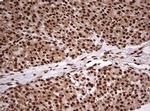 FBXW7 Antibody in Immunohistochemistry (Paraffin) (IHC (P))