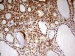 FBXW7 Antibody in Immunohistochemistry (Paraffin) (IHC (P))