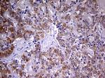 MRPS11 Antibody in Immunohistochemistry (Paraffin) (IHC (P))