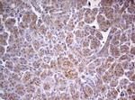 MRPS11 Antibody in Immunohistochemistry (Paraffin) (IHC (P))