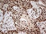 FBXW7 Antibody in Immunohistochemistry (Paraffin) (IHC (P))