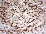 FBXW7 Antibody in Immunohistochemistry (Paraffin) (IHC (P))