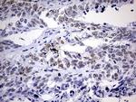 NAB1 Antibody in Immunohistochemistry (Paraffin) (IHC (P))