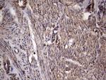 DOCK8 Antibody in Immunohistochemistry (Paraffin) (IHC (P))