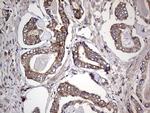 DOCK8 Antibody in Immunohistochemistry (Paraffin) (IHC (P))