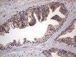 DOCK8 Antibody in Immunohistochemistry (Paraffin) (IHC (P))