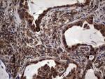 DOCK8 Antibody in Immunohistochemistry (Paraffin) (IHC (P))