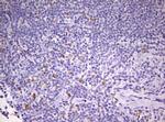 PRRX1 Antibody in Immunohistochemistry (Paraffin) (IHC (P))