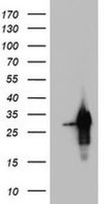 PRRX1 Antibody in Western Blot (WB)