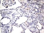 PRRX1 Antibody in Immunohistochemistry (Paraffin) (IHC (P))