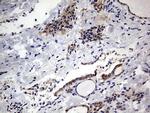 PRRX1 Antibody in Immunohistochemistry (Paraffin) (IHC (P))