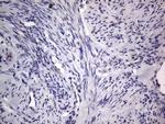 PRRX1 Antibody in Immunohistochemistry (Paraffin) (IHC (P))