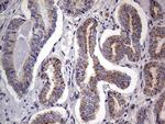 PRRX1 Antibody in Immunohistochemistry (Paraffin) (IHC (P))