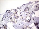 PRRX1 Antibody in Immunohistochemistry (Paraffin) (IHC (P))