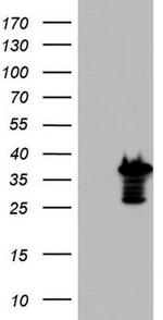 PRRX1 Antibody in Western Blot (WB)