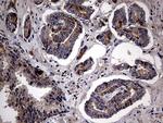 PLOD2 Antibody in Immunohistochemistry (Paraffin) (IHC (P))