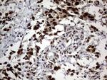 DDX56 Antibody in Immunohistochemistry (Paraffin) (IHC (P))