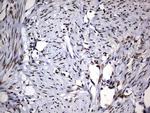 DDX56 Antibody in Immunohistochemistry (Paraffin) (IHC (P))