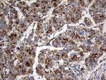 GBA Antibody in Immunohistochemistry (Paraffin) (IHC (P))