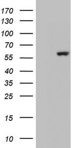 GBA Antibody in Western Blot (WB)