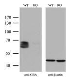 GBA Antibody in Western Blot (WB)