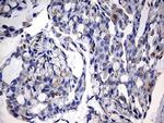 GBA Antibody in Immunohistochemistry (Paraffin) (IHC (P))