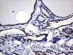 GBA Antibody in Immunohistochemistry (Paraffin) (IHC (P))