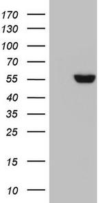 GBA Antibody in Western Blot (WB)