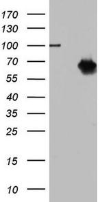 TR2 Antibody in Western Blot (WB)