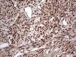 Macro H2A.2 Antibody in Immunohistochemistry (Paraffin) (IHC (P))