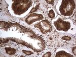 Macro H2A.2 Antibody in Immunohistochemistry (Paraffin) (IHC (P))