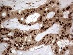 Macro H2A.2 Antibody in Immunohistochemistry (Paraffin) (IHC (P))