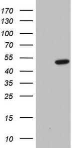 Macro H2A.2 Antibody in Western Blot (WB)