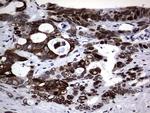 Macro H2A.2 Antibody in Immunohistochemistry (Paraffin) (IHC (P))