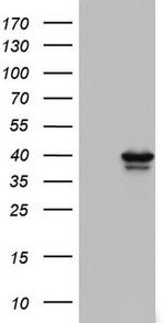 Macro H2A.2 Antibody in Western Blot (WB)