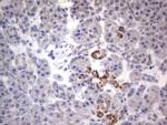 CHCHD3 Antibody in Immunohistochemistry (Paraffin) (IHC (P))