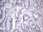 CHCHD3 Antibody in Immunohistochemistry (Paraffin) (IHC (P))