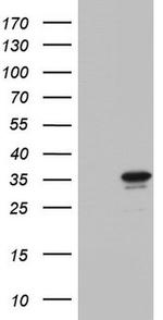 CHCHD3 Antibody in Western Blot (WB)