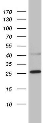 CHCHD3 Antibody in Western Blot (WB)