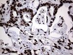 Macro H2A.2 Antibody in Immunohistochemistry (Paraffin) (IHC (P))