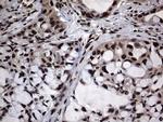 Macro H2A.2 Antibody in Immunohistochemistry (Paraffin) (IHC (P))