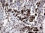 Macro H2A.2 Antibody in Immunohistochemistry (Paraffin) (IHC (P))