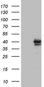 Macro H2A.2 Antibody in Western Blot (WB)