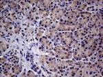 ABCD1 Antibody in Immunohistochemistry (Paraffin) (IHC (P))