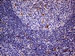 ABCD1 Antibody in Immunohistochemistry (Paraffin) (IHC (P))