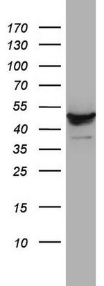 DDOST Antibody in Western Blot (WB)