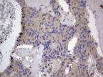 ASM Antibody in Immunohistochemistry (Paraffin) (IHC (P))