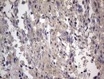 ASM Antibody in Immunohistochemistry (Paraffin) (IHC (P))